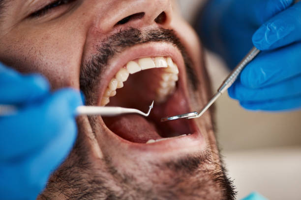 Best Emergency Dental Care for Trauma or Injury in Tucson Estates, AZ